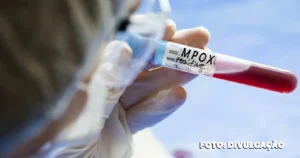 Cidade do Rio já registra mais de 3 mil notificações de Mpox